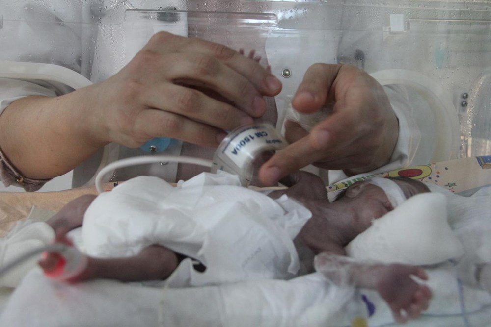 "Parmak bebek" hayata tutundu Sağlık Haberleri NTV "Parmak bebek" hayata tutundu Sağlık Haberleri NTV