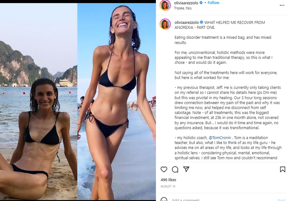 Yeme bozukluğu yaşayan Olivia Arezzolo'nun hayatı bir fotoğrafla değişti - 7