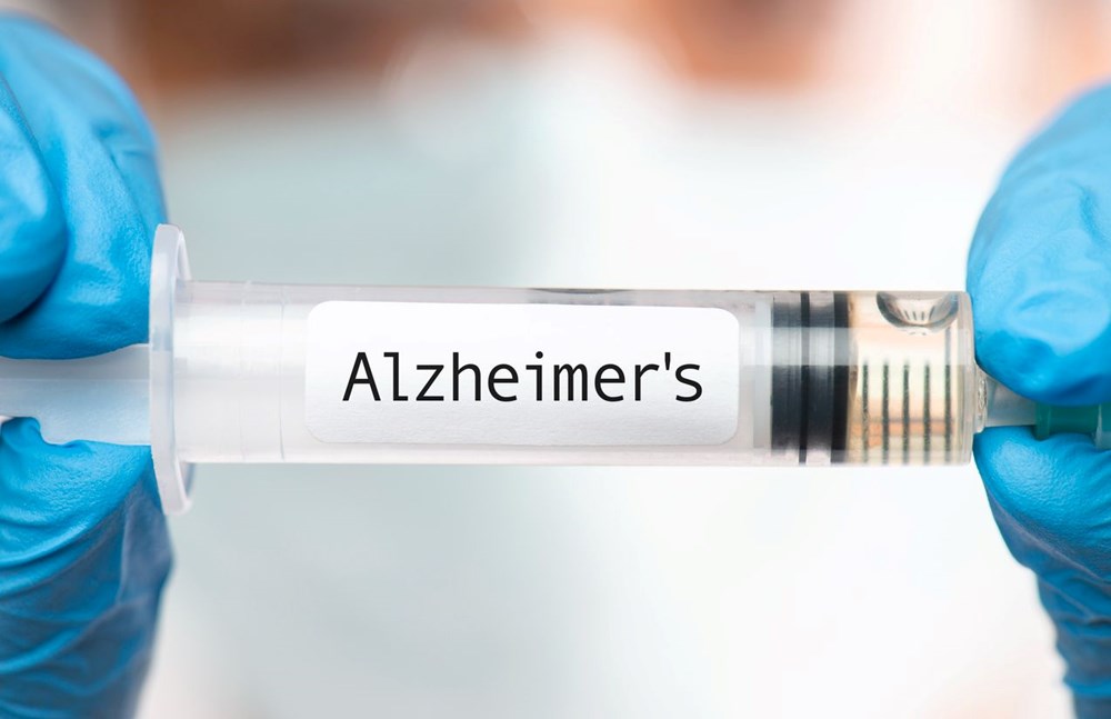 Alzheimer hastaları için gerçek bir tedavi sunan ilk ilaç: Lecanemab nedir? Lecanemab'ın yan etkileri nelerdir? - 9