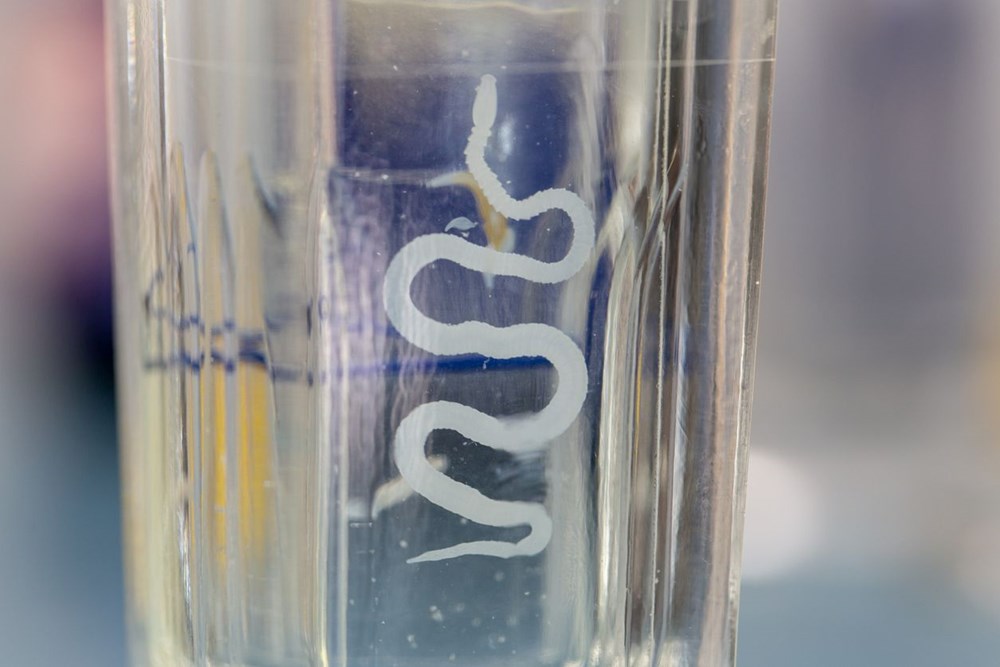 Doktorları şaşırtan görüntü: Tenyalar organlarını delik deşik etti - 7