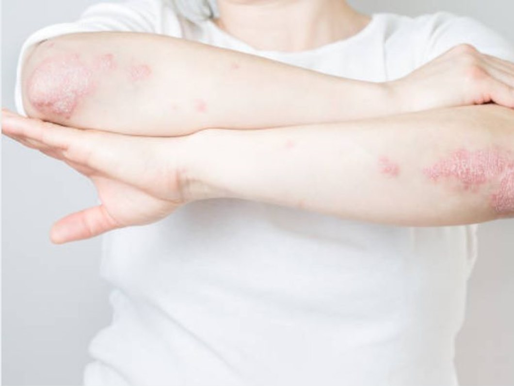 gizli seker neden olur gizli seker belirtileri nelerdir