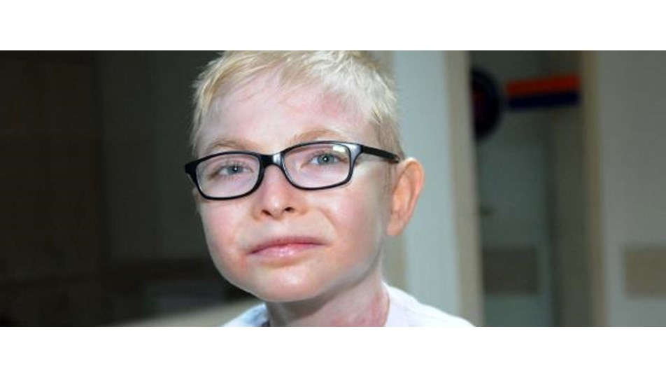 mucize cocugun hedefi genetik