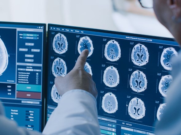 burun akintisi beyin omurilik sivisi