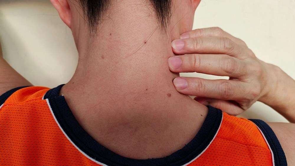 Boynunda başladı, beynine kadar yayıldı: Önemsemediği işaret kanserin belirtisiymiş - 1