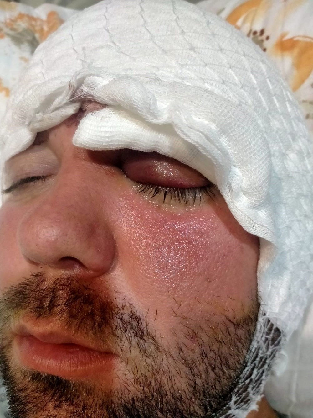 İmplant tedavisinde vida beynine saplandı: Yanlış tedavi hayatını kararttı - 7