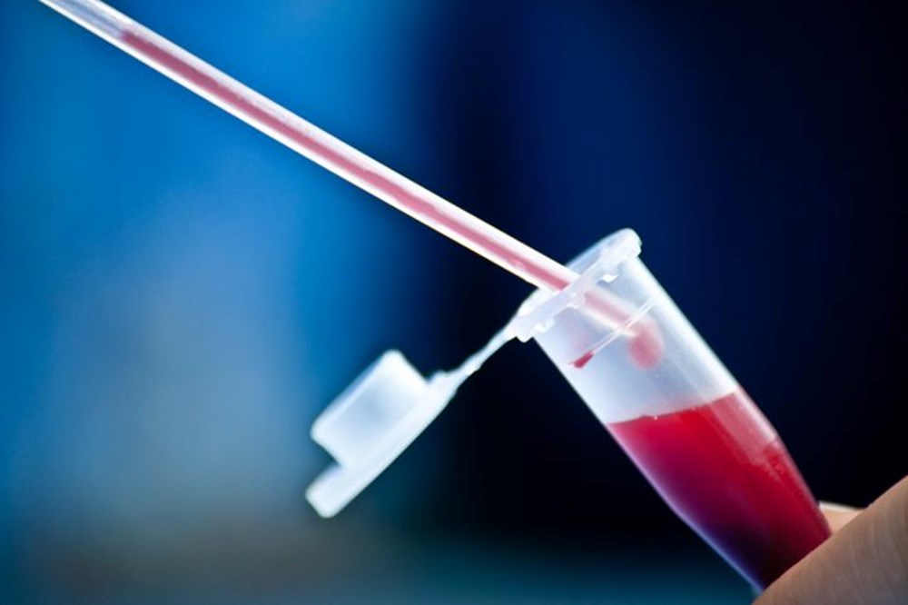 Kan grubunuza göre çarpıcı gerçek ortaya çıktı! Japon araştırmacılar uyardı - 17
