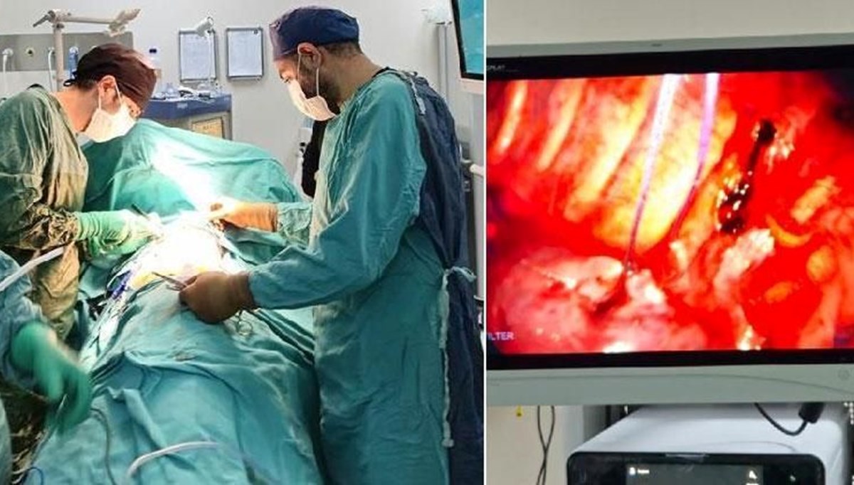 Kavgada akciğerine bıçak saplandı Kavgada akciğerine bıçak saplandı