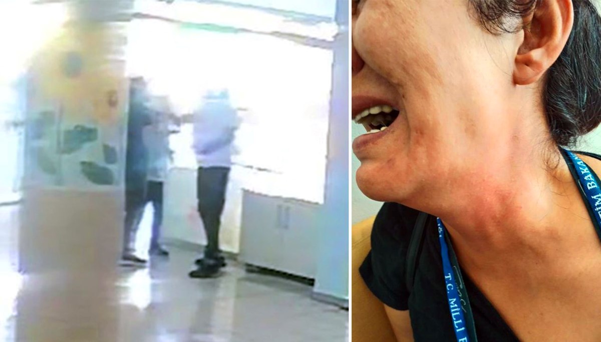 Antalya'da öğretmene saldırı