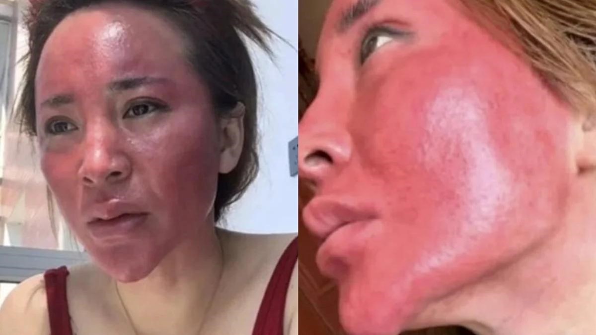 Gao isimli kadın üyüzünün son halini paylaştı Gao isimli kadın üyüzünün son halini paylaştı