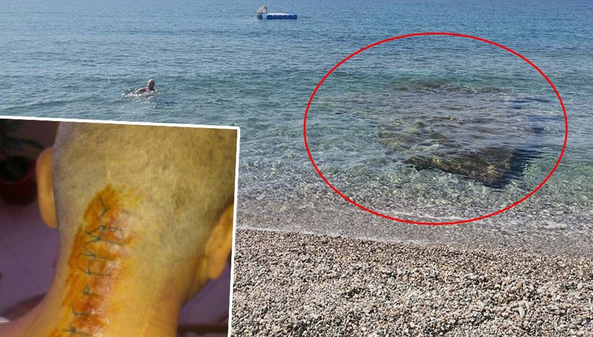 İzmir’de emekli albayı sakat bırakan kaya | Mavi bayraklı plajdaki tehlike İzmir’de emekli albayı sakat bırakan kaya | Mavi bayraklı plajdaki tehlike