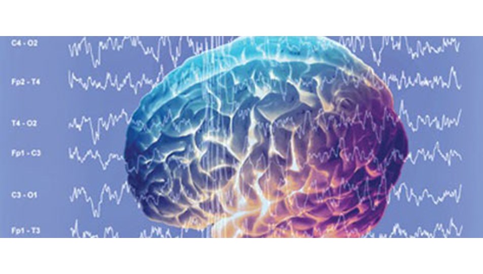 Otizm, bebek 6 aylıkken fark edilebilir Sağlık Haberleri Otizm, bebek 6 aylıkken fark edilebilir Sağlık Haberleri