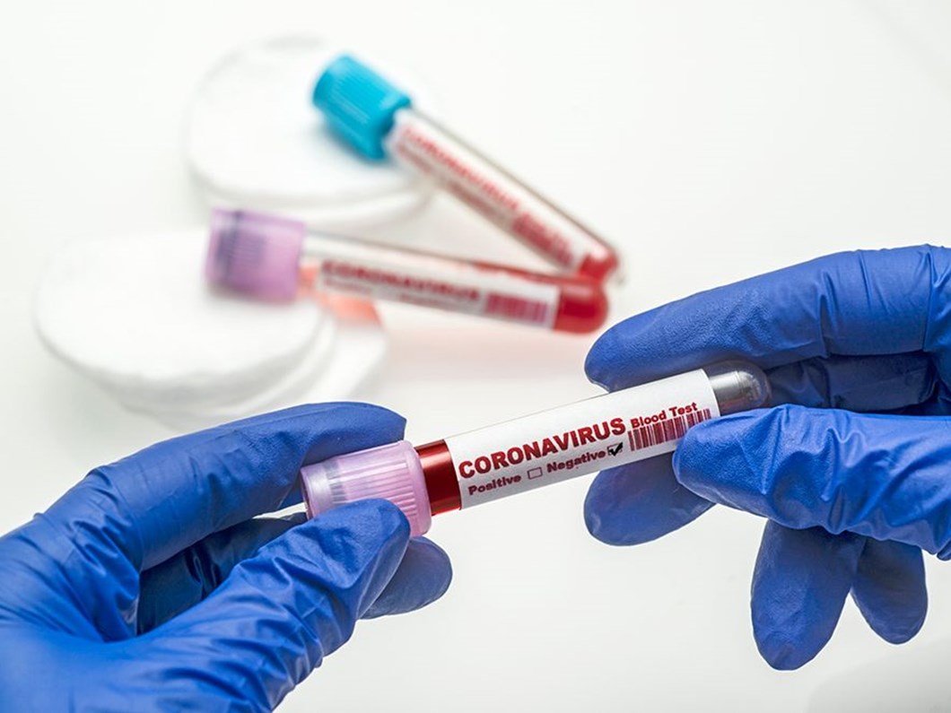 21 agustos 2021 corona virus tablosu 232 can kaybi 19 bin 351 yeni vaka ntv