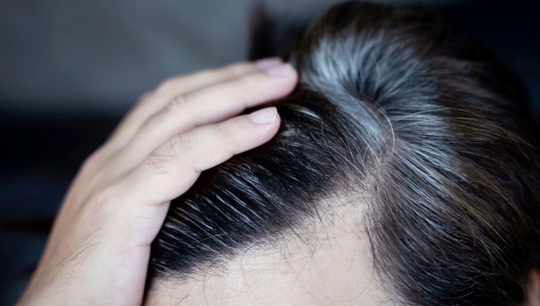 Vücuttaki eksikliği saçları beyazlatıyor: Bu işaretlere dikkat