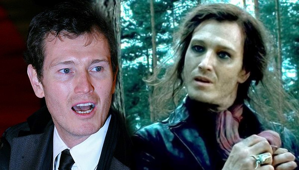 Harry Potter oyuncusu Nick Moran ameliyat oldu