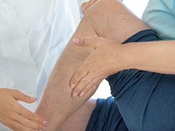 varis tedavi edilmezse olumcul olabilir saglik haberleri ntv