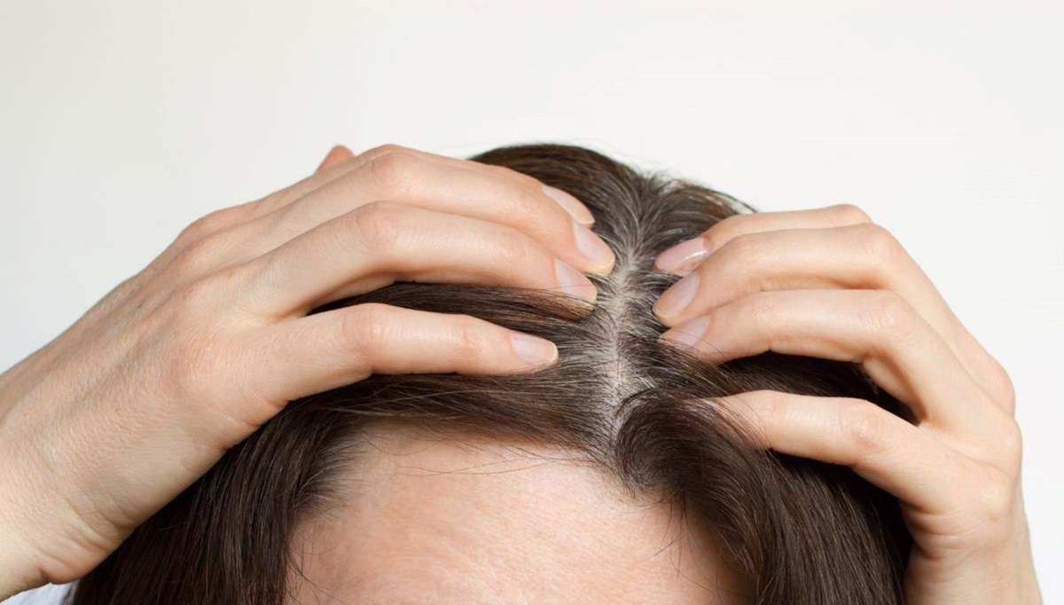 Saçlardaki beyazlaşmayı tersine çevirmek veya önlemek mümkün mü? Umut veren araştırma