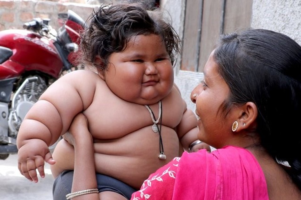 Görenler şaşırıyor, 8 aylık Chahat Kumar bebek 17 kilo! - 4