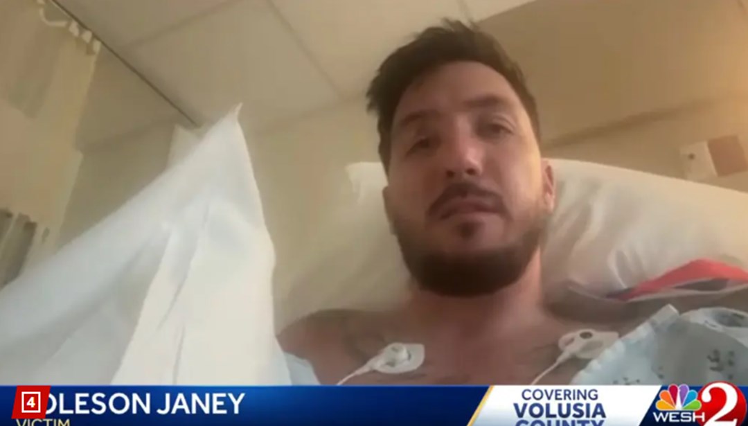 Plajda güneşlenirken üzerinden cip geçti! "Başımı ezen lastikle uyandım"