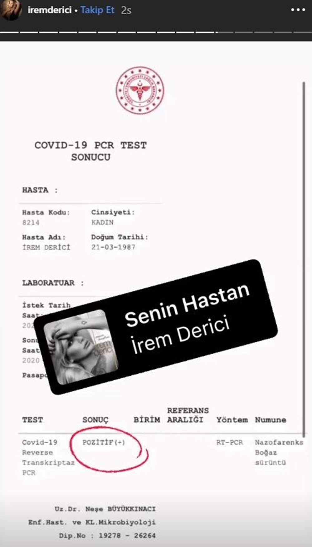 İrem Derici corona virüse yakalandı - 2