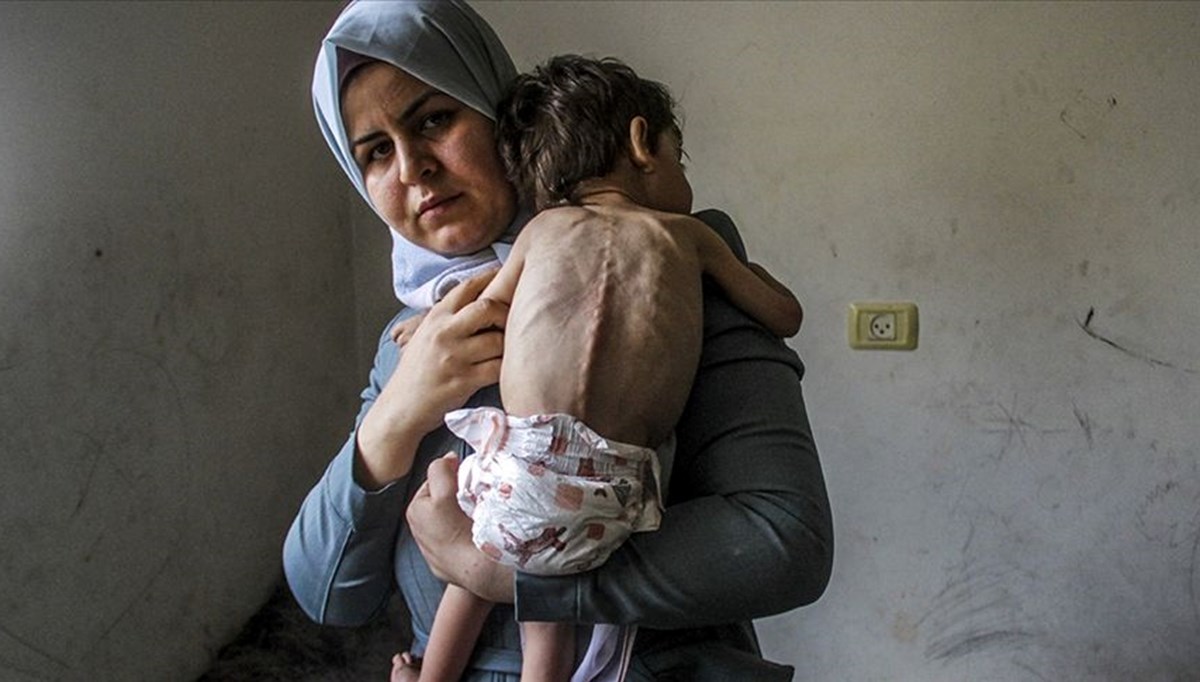 Hamas: 40'tan fazla çocuk açlıktan öldü Hamas: 40'tan fazla çocuk açlıktan öldü
