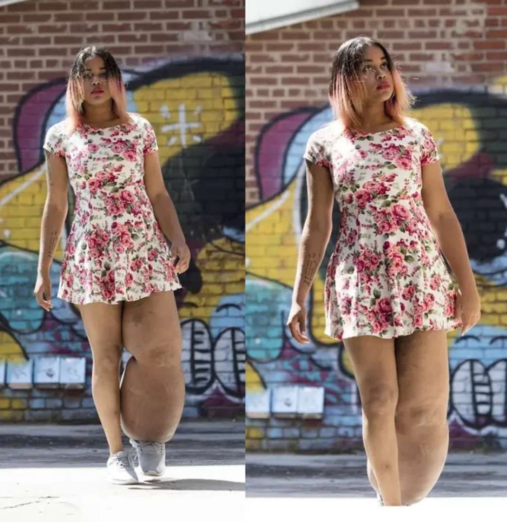 Doğuştan lenfödemili (fil hastalığı) Mahogany Geter acımasız eleştirilere rağmen görünüşüyle barışık yaşıyor - 8