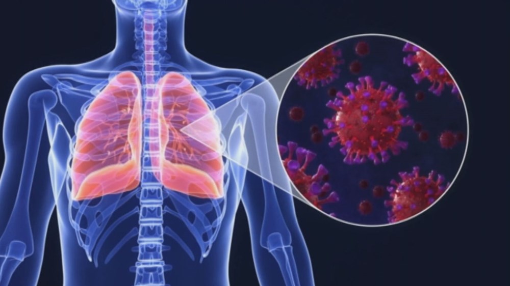 Yerli yapay zeka ile birkaç saniyede Covid-19 teşhisi - 1