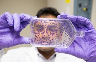 kemoterapi tek secenek degil