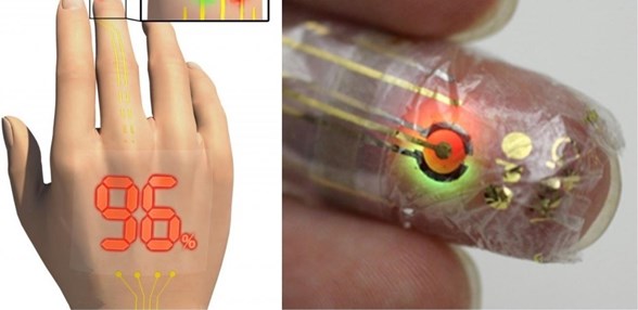 anevrizmanin 5 sinyali saglik