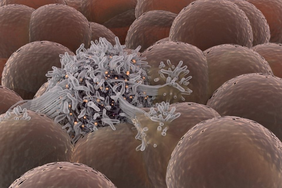 Kanserle mücadelede yeni strateji: Ölümsüz kanser kök hücresi "Aşil topuğu”ndan vurulabilir mi? - 3