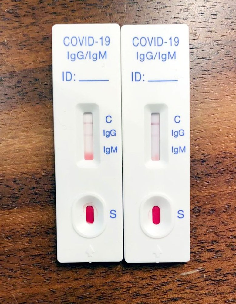 uzmanlardan evde hizli covid testi uyarisi teshis icin kullanilamaz saglik haberleri ntv uzmanlardan evde hizli covid testi uyarisi teshis icin kullanilamaz saglik haberleri ntv
