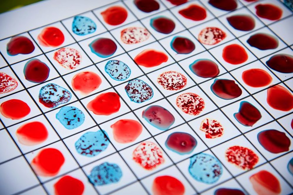Kan grubunuza göre çarpıcı gerçek ortaya çıktı! Japon araştırmacılar uyardı - 6