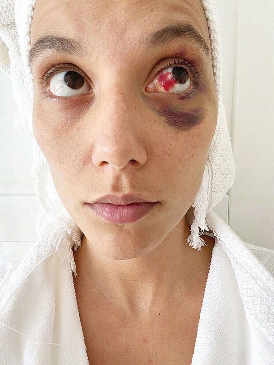 SON DAKİKA: Deniz Bulutsuz'u darp ettiği öne sürülen Ozan Güven hakkında 13,5 yıla kadar hapis istemi - 1