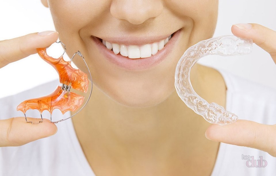 "Diş estetiğinde yeni trend; ortodontik tedavi" - 1