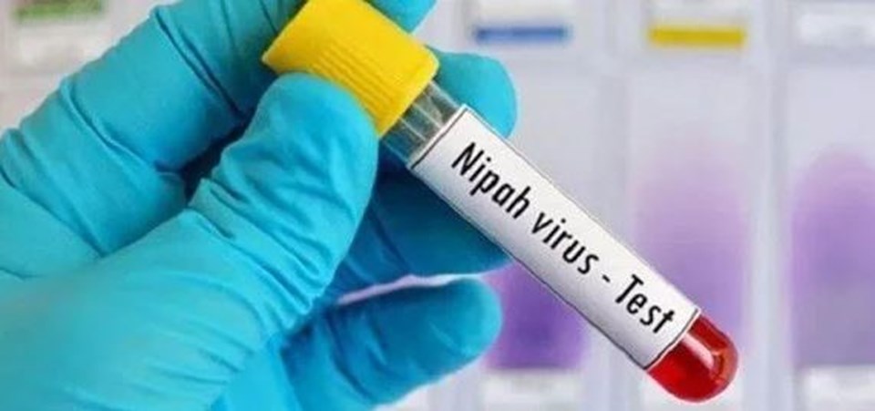 Nipah virüsü nedir, belirtileri neler? Nipah virüsü bulaşma yolları - 1