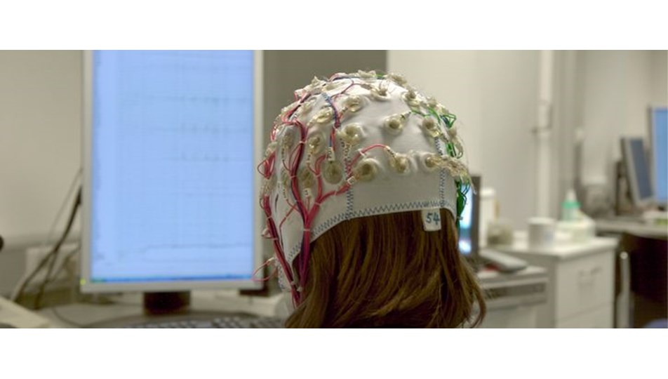 Epilepsi hastaları damgalanma ile karşı karşıya