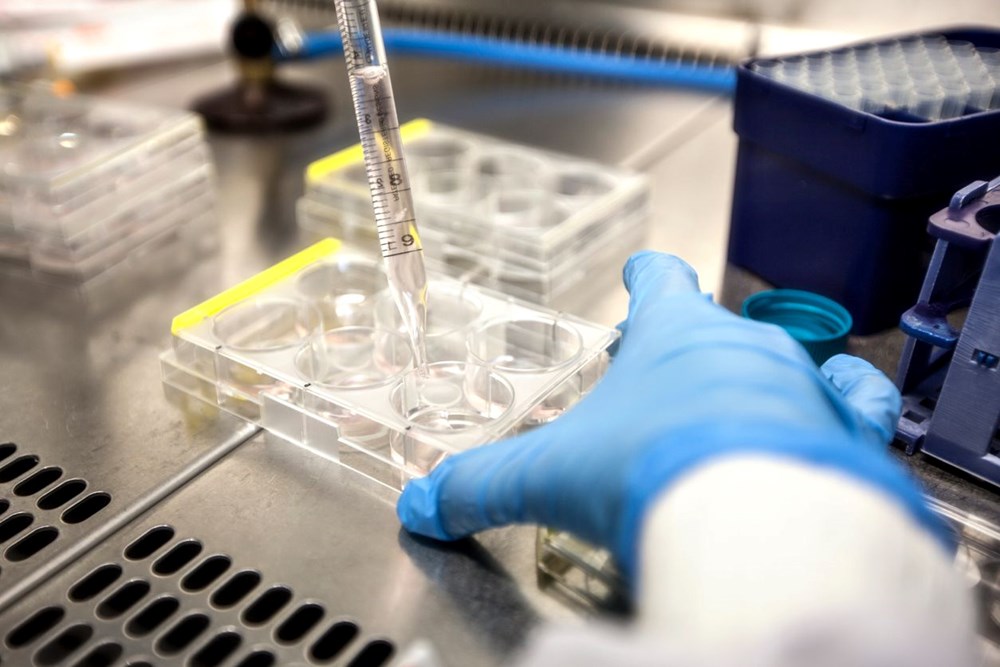 mRNA teknolojisini kullanan HIV aşısı testleri başladı - 1