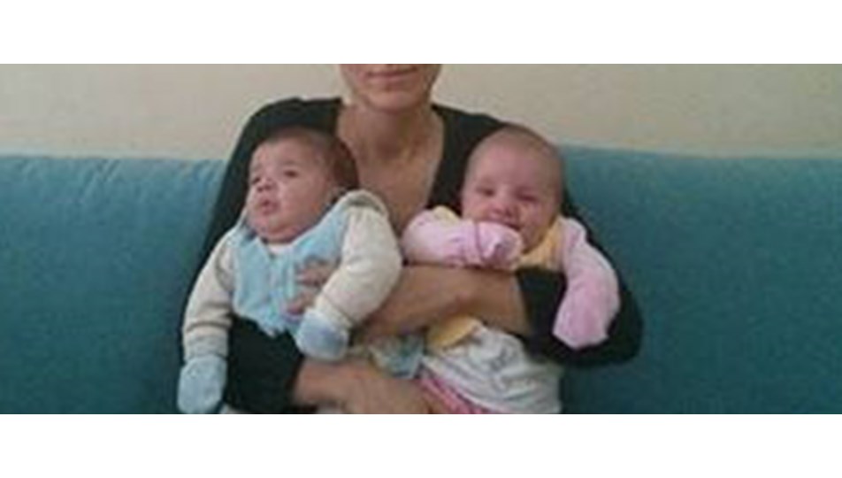 İkizlere �sağlık� umudu NTV İkizlere �sağlık� umudu NTV