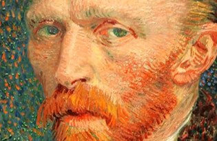 bipolar bozukluk nedir neden olur 30