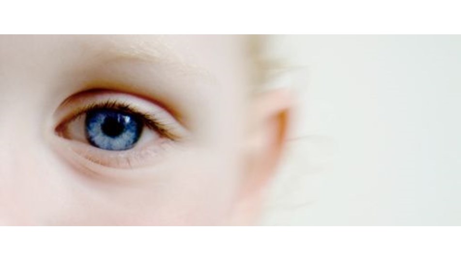 Her 160 Cocuktan Biri Otizm Sendromlu Saglik Haberleri Ntv