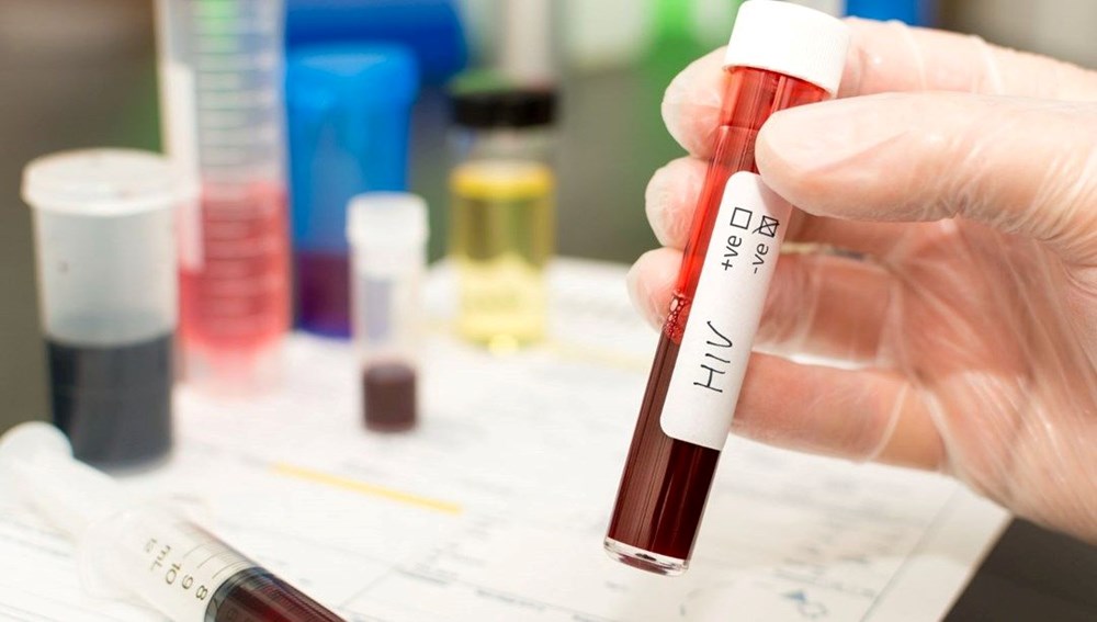 Türkiye'de HIV artış eğiliminde: Gizli pandemi gibi! - 6