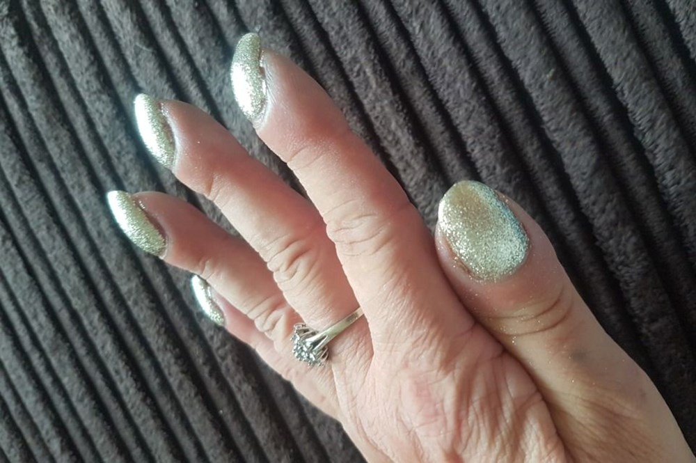 Akciğer kanseri riski için basit parmak testi: Schamroth Testi nasıl yapılır? - 8