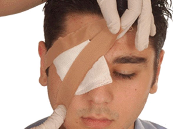 goze acil mudahale nasil yapilir saglik haberleri ntv