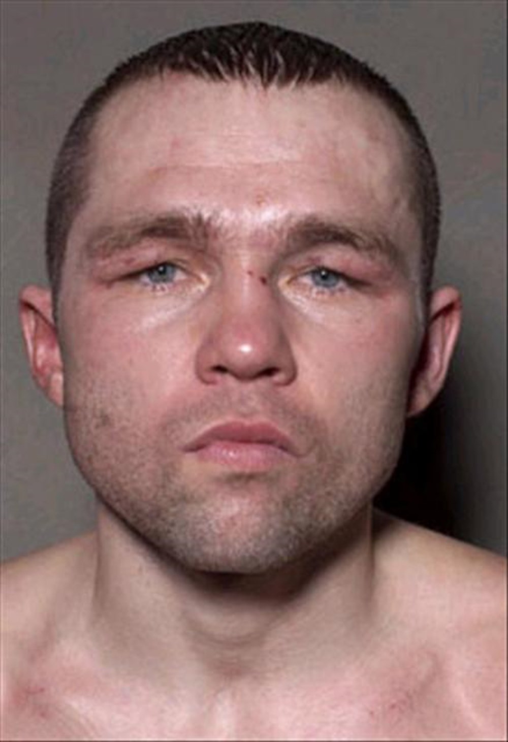 Лицо после драки фото Лицо после драки фото