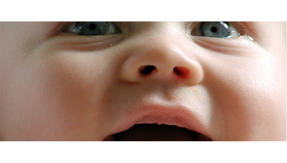 Через сколько вылазит зуб - найдено 89 фото