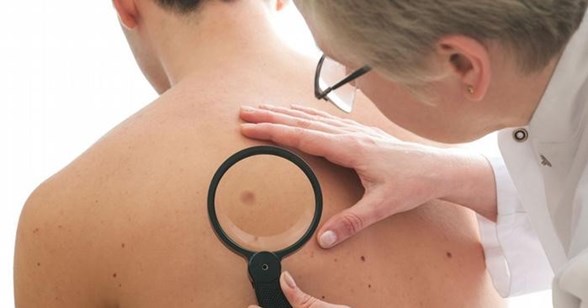 sicak hava cilt hastaliklarini