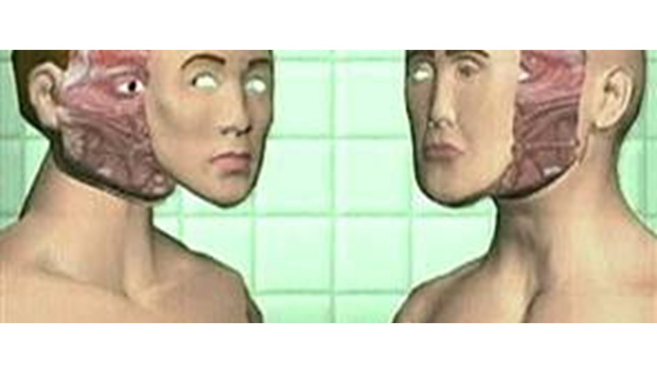 Как выглядит пересадка кожи Как выглядит пересадка кожи