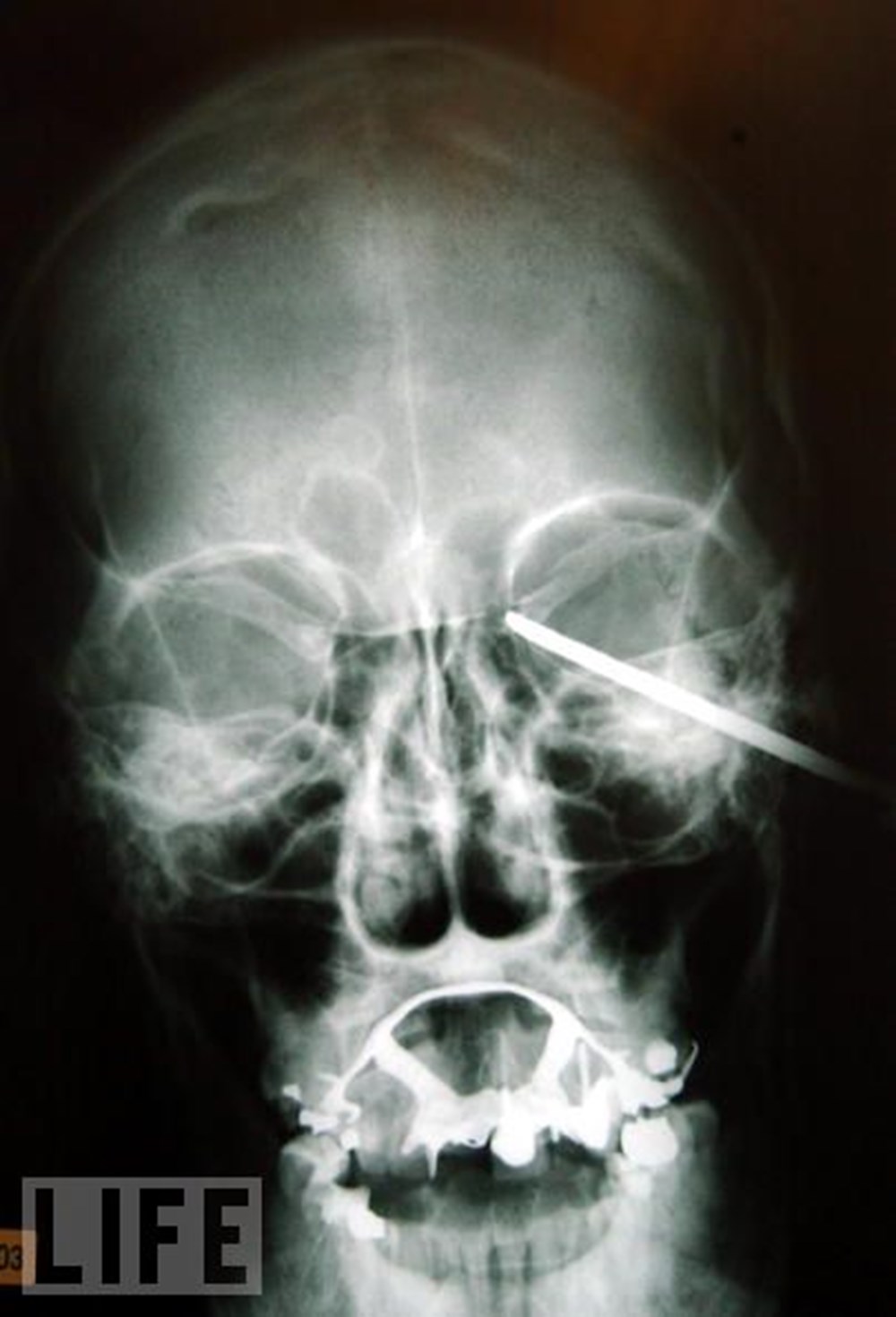 Hayatın röntgeni NTV Hayatın röntgeni NTV