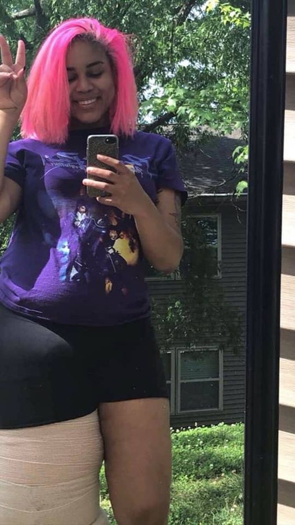 Doğuştan lenfödemili (fil hastalığı) Mahogany Geter acımasız eleştirilere rağmen görünüşüyle barışık yaşıyor - 4