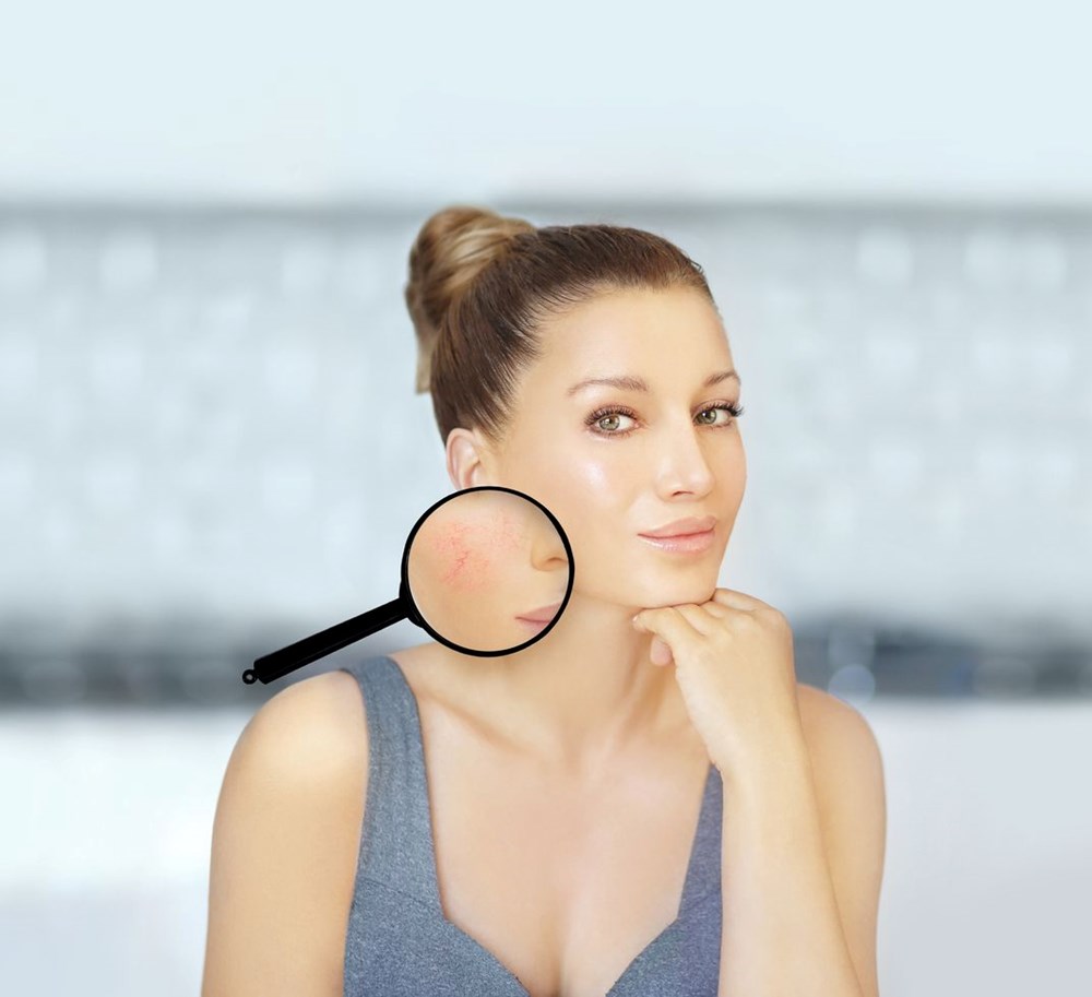 İnsan yüzünde yüzbinlerce akar yaşıyor: Demodex nedir? - 2