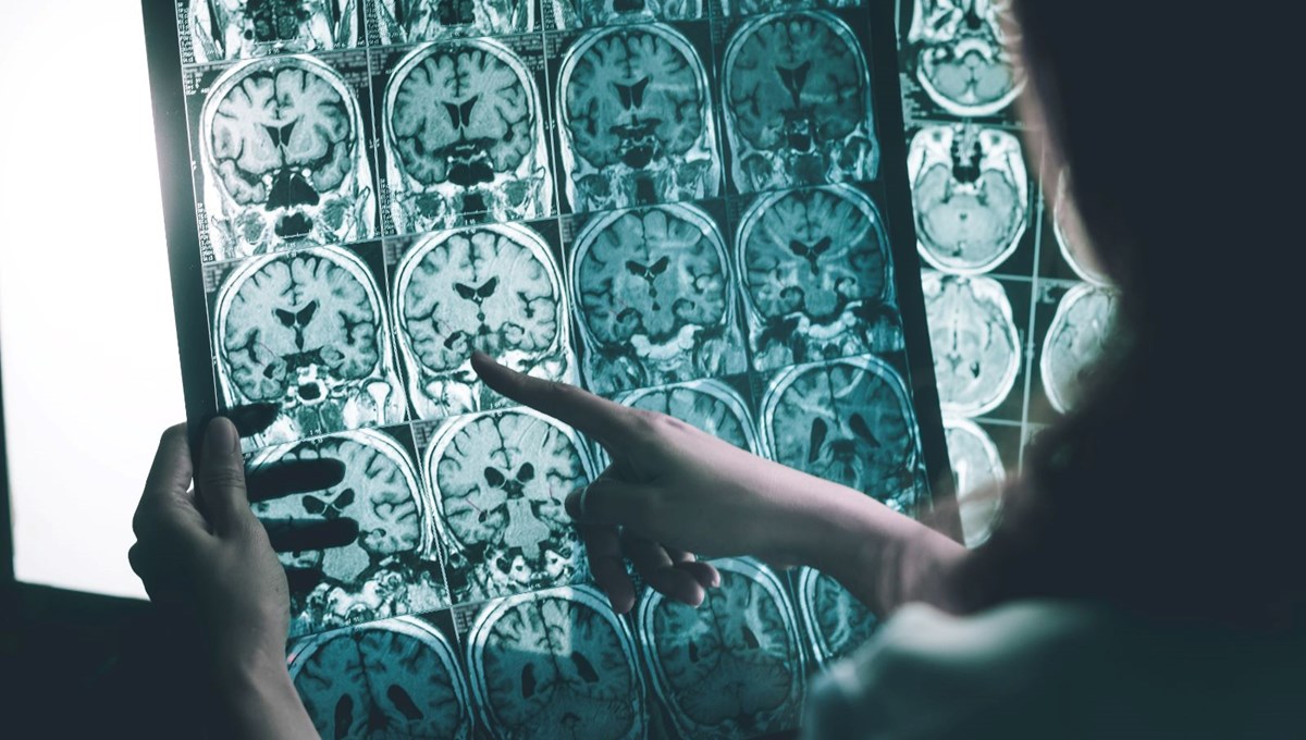 Stresli işlere karşı elektronik dövme